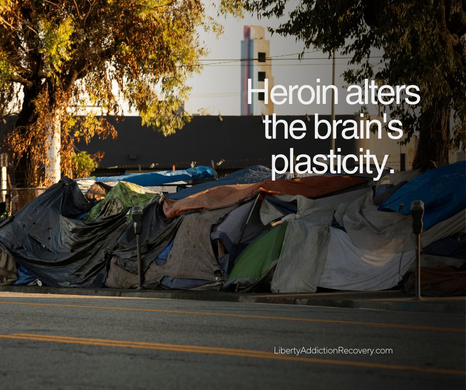 Heroin alters the brains plasticity